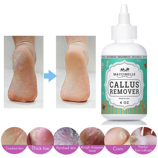 Maccibelle gel applied to heel close-up demonstrating targeted softening benefit