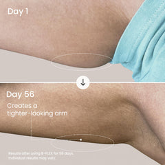 MAËLYS B-FLEX being applied to upper arm for smoother appearance