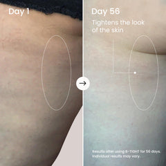 MAËLYS before and after scale illustrating visible smoothing of skin texture