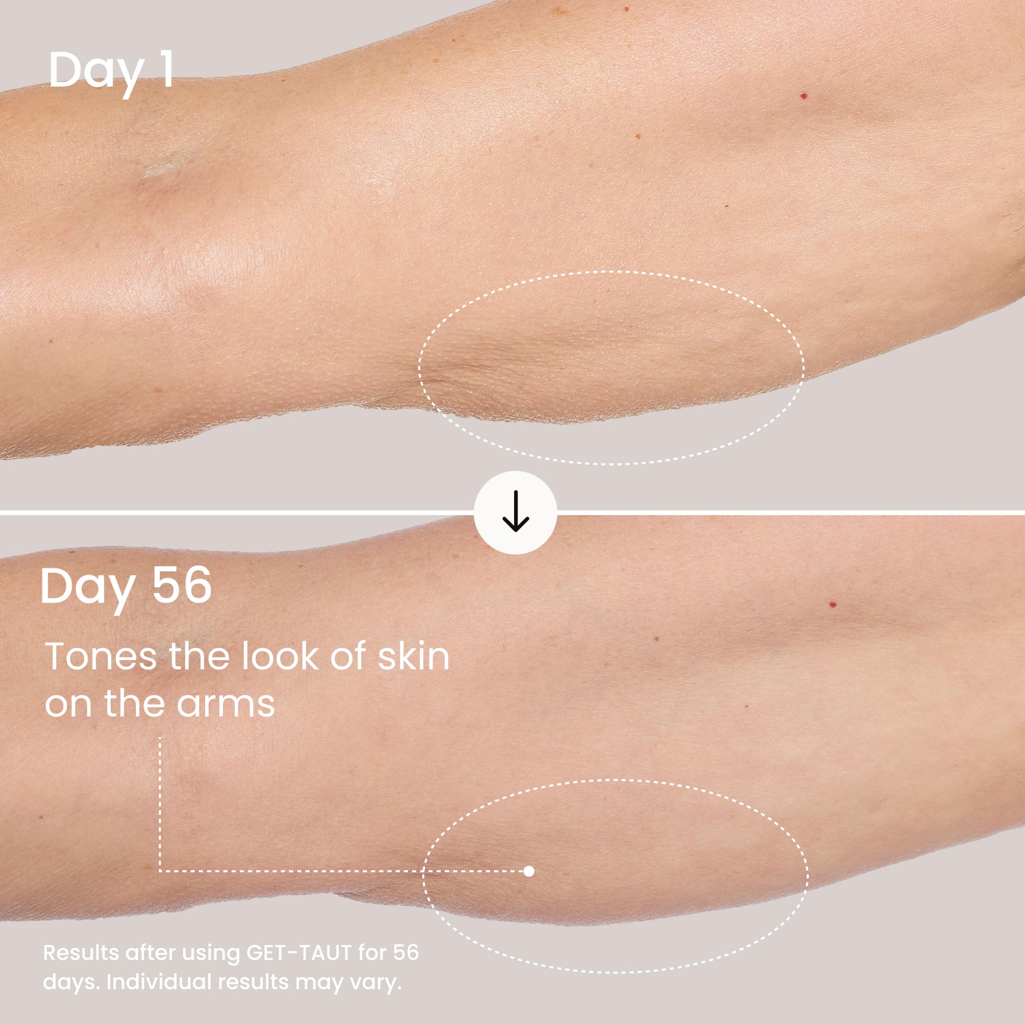 MAËLYS before and after thighs visualizing improved-looking texture and softness