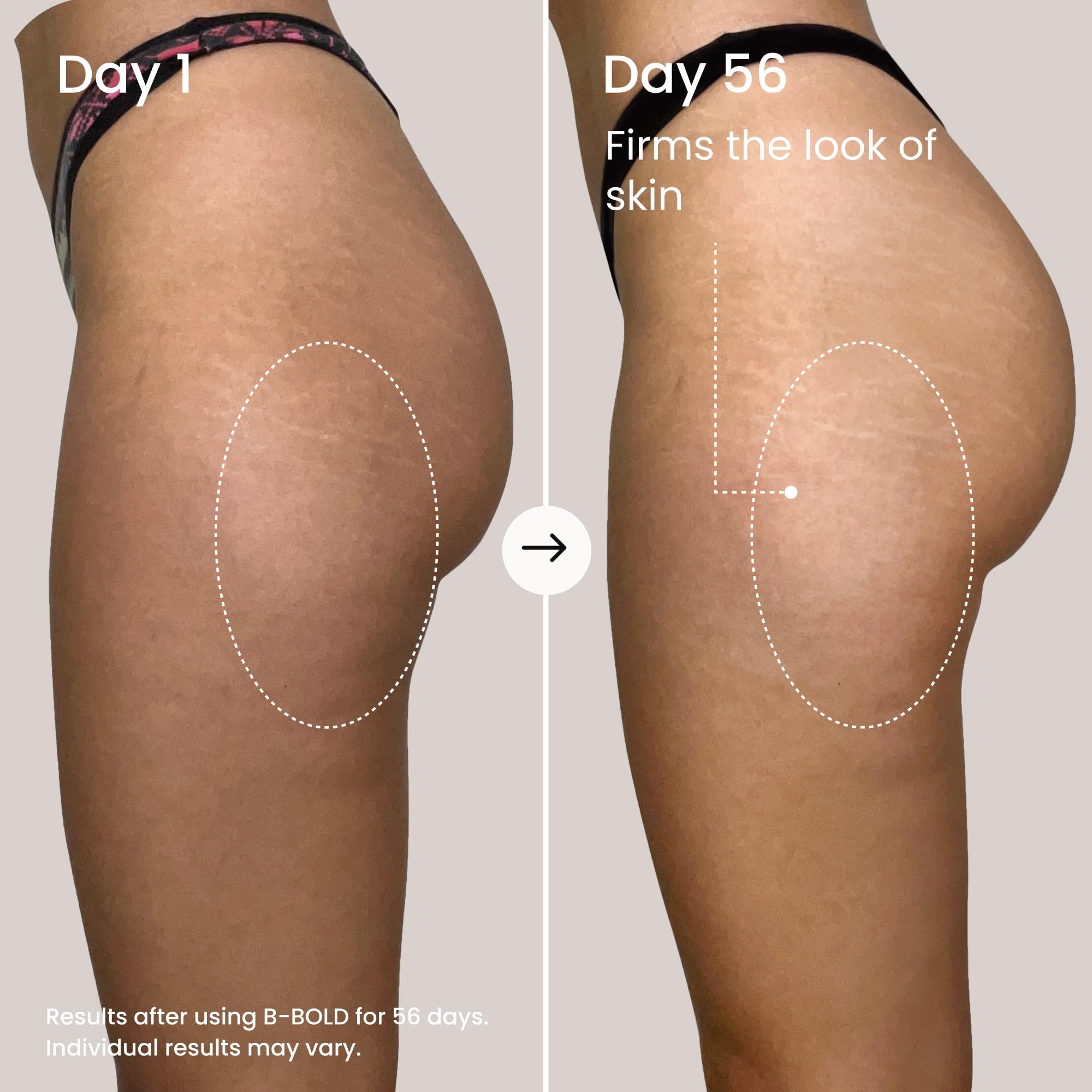 MAËLYS cream applied to skin area showing visible smoothing and hydration effect