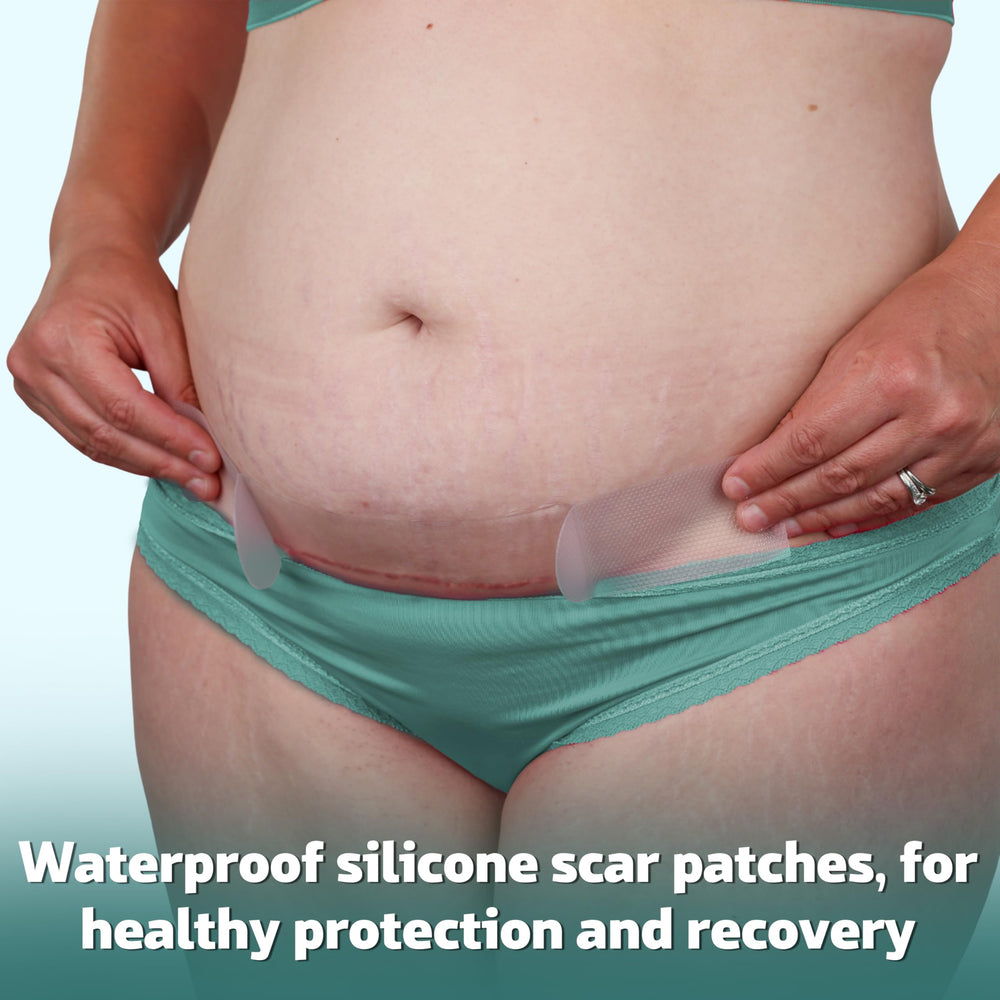 Mama & Wish no-rinse wipes single wipe open for hygienic, incision-safe cleaning