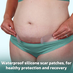 Mama & Wish no-rinse wipes single wipe open for hygienic, incision-safe cleaning