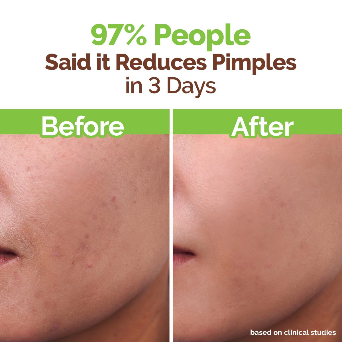 MAMAEARTH gentle lather on face demonstrating oil-clearing benefit