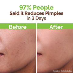 MAMAEARTH gentle lather on face demonstrating oil-clearing benefit