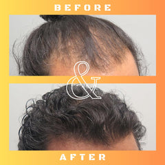 Mane Regain 30ml bottle beside a ruler showing compact travel-friendly benefit