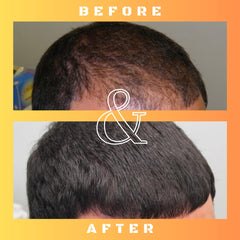 Mane Regain texture drop on skin demonstrating fast absorption benefit