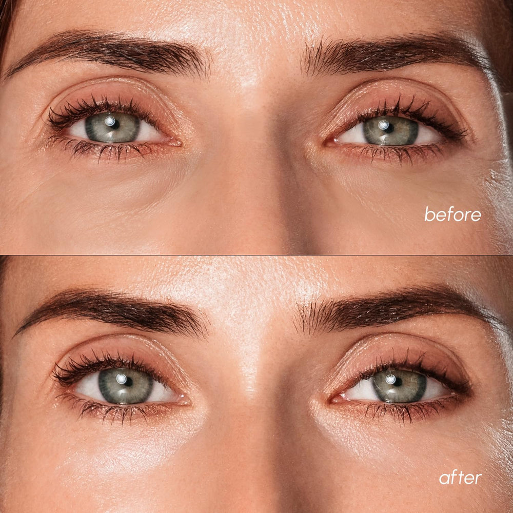 MAREE patches applied under eye providing cooling and de-puffing