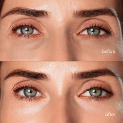 MAREE patches applied under eye providing cooling and de-puffing