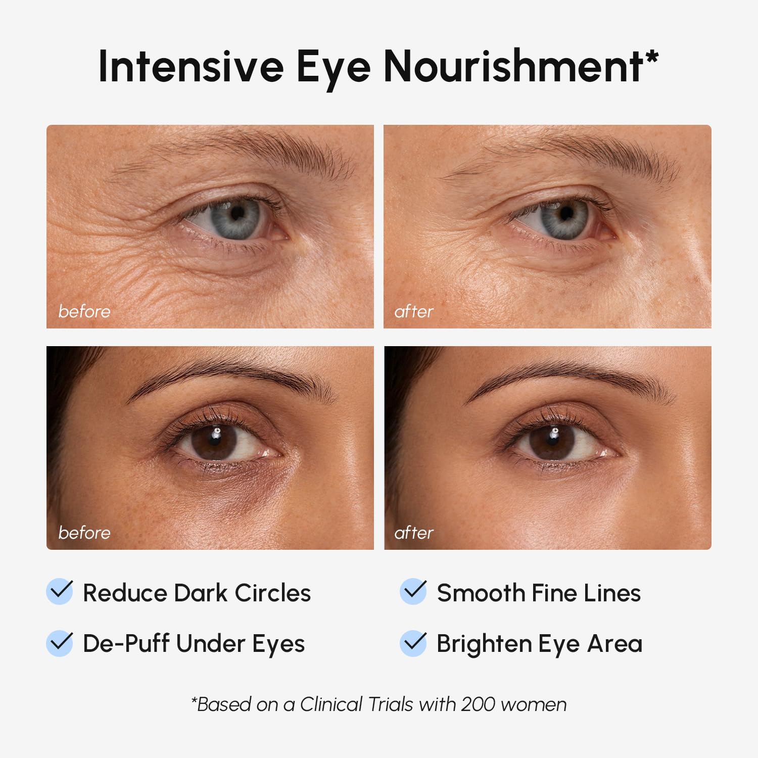 MAREE patch applied under eye demonstrating discreet fit and immediate depuffing benefit