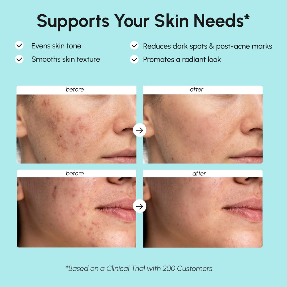 MAREE ingredient label highlighting niacinamide and salicylic acid benefits