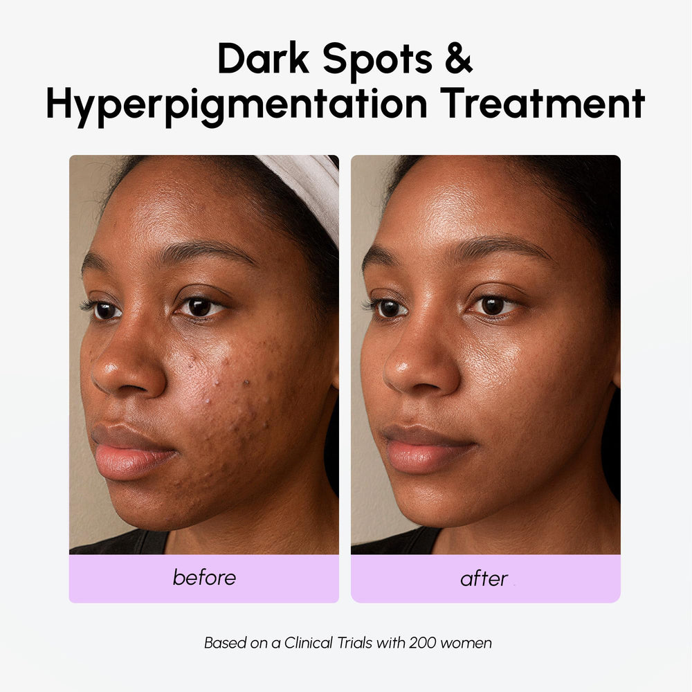 MAREE serum applied to neck and décolletage for even tone benefit