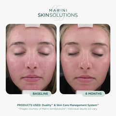Marini SkinSolutions pump dispensing product ready to mix and apply