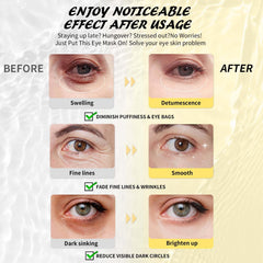 Maskiss patches applied under eye demonstrating instant plumping
