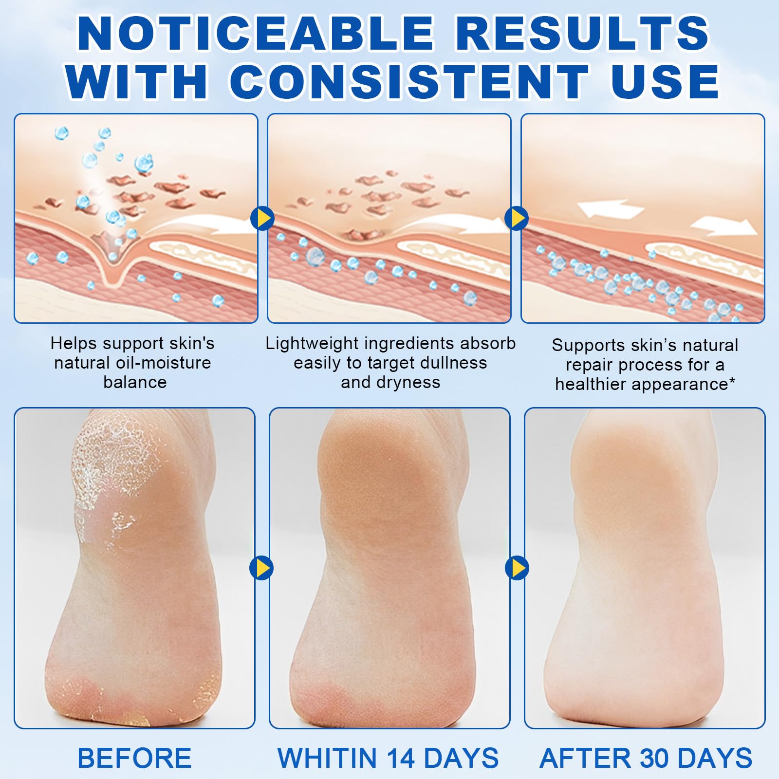 Mcukv before and after heels comparison showing softened, smoother skin