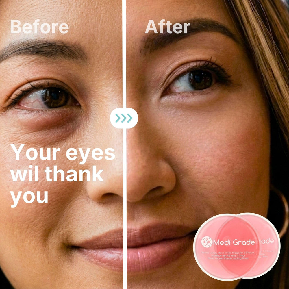 Medi Grade mask worn by model relaxing to reduce eye puffiness