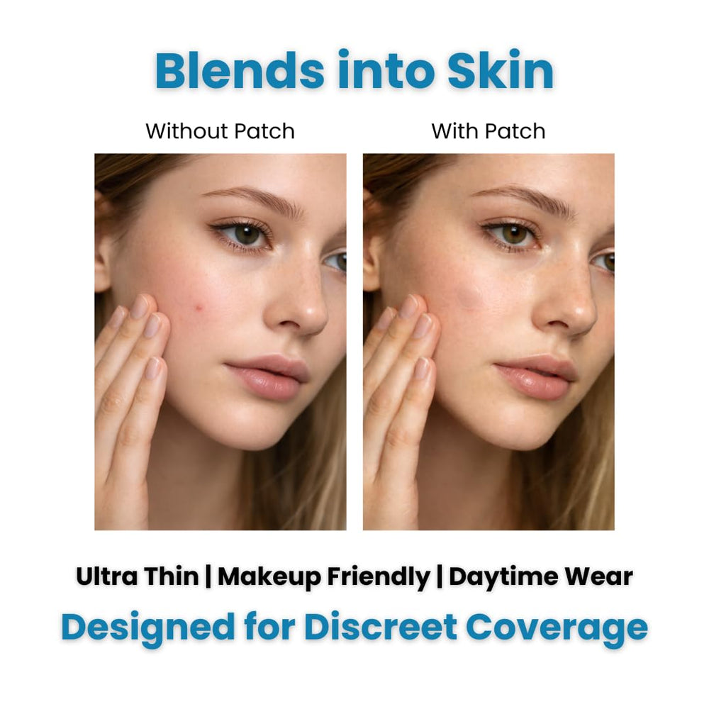 Medical Miracles patch worn on face in daylight lifestyle photo showing invisible coverage and confidence