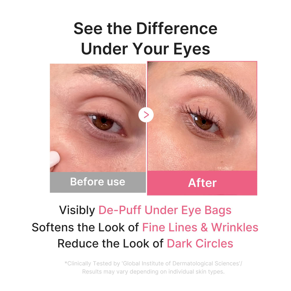 medicube model wearing patch under eye showing cooling effect