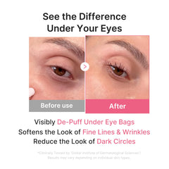 medicube model wearing patch under eye showing cooling effect