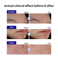 MEDIHEAL single patch close-up highlighting thin profile and discreet finish for wearing