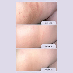 Megababe Night Rescue being applied to thigh for soothing and tone-evening benefits