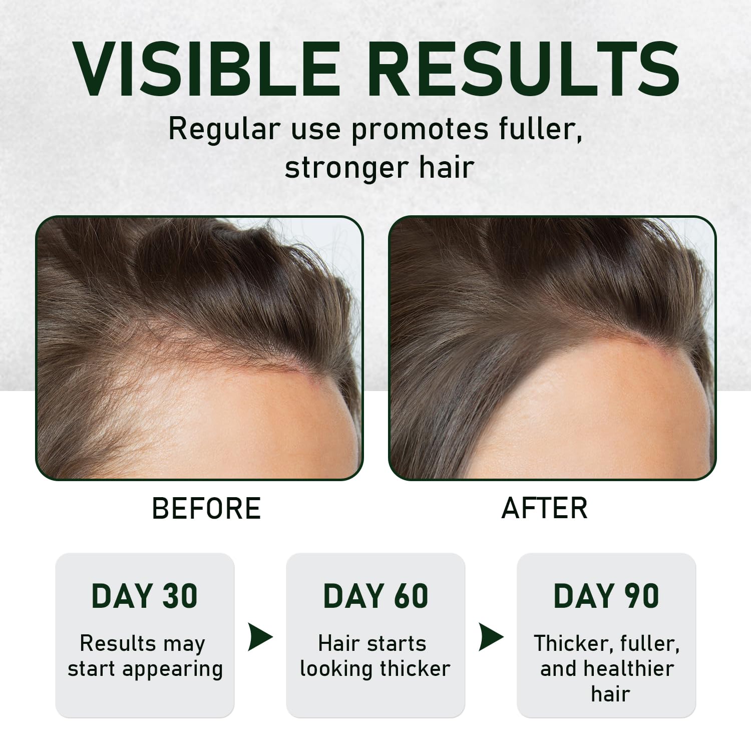 Melopuff batana scalp massage in progress, promotes better scalp hydration benefit