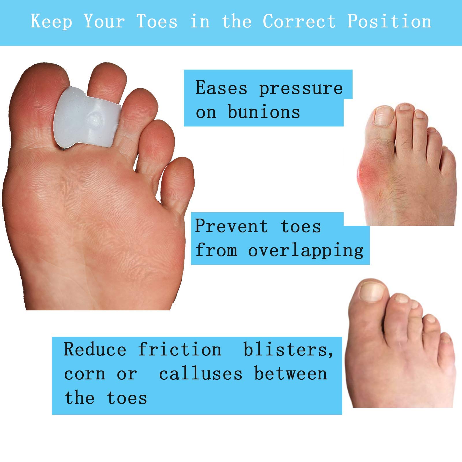 MENOCADY single-loop detail on second toe for secure placement benefit