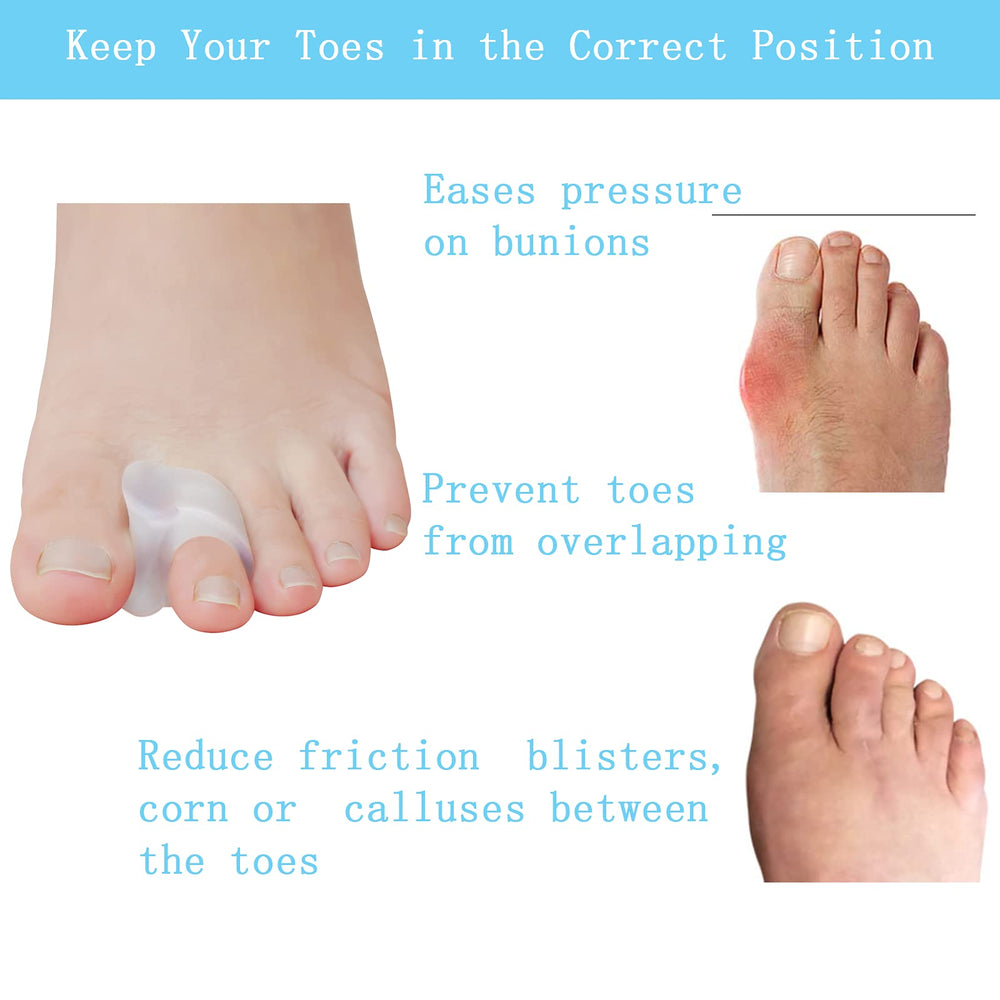 MENOCADY single-loop detail highlighting loop that secures spacer to second toe