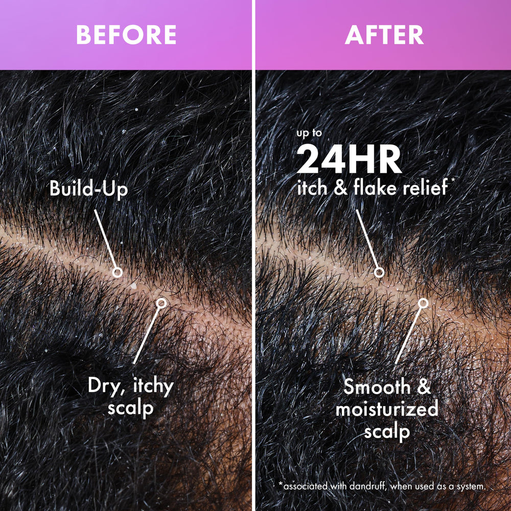 Mielle Organics applied to scalp demonstrating targeted hydration