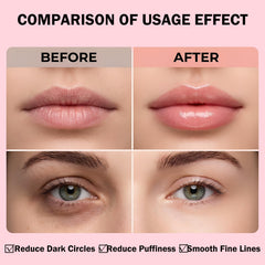 Minfei masks in use with under-eye patches and lip mask demonstrating quick application