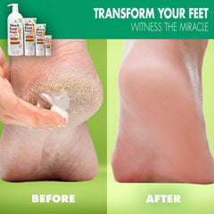 Miracle of Aloe foot cream tube closeup highlighting applicator and texture