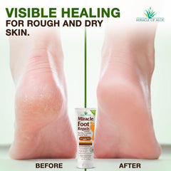 Miracle of Aloe three-pack layout illustrating convenient multi-pack supply