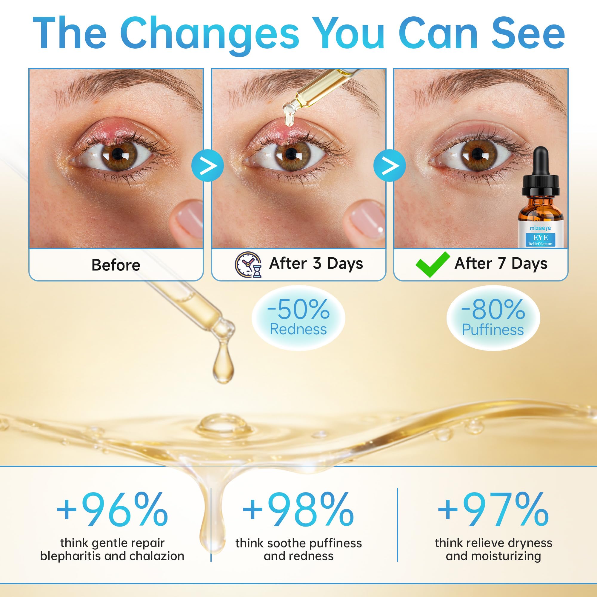 MIZEEYE being applied to eyelid area demonstrating gentle massage and relief benefit