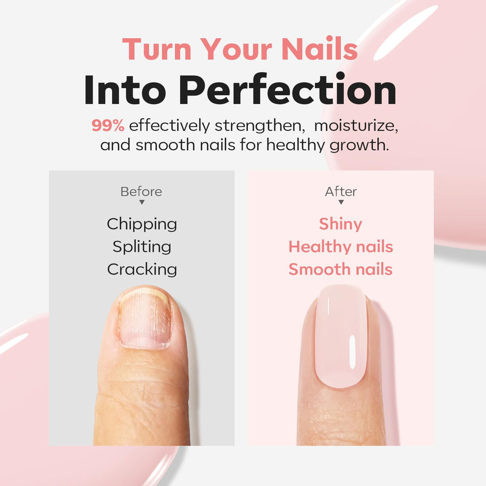 modelones before and after nail compare showing reduced discoloration and improvement