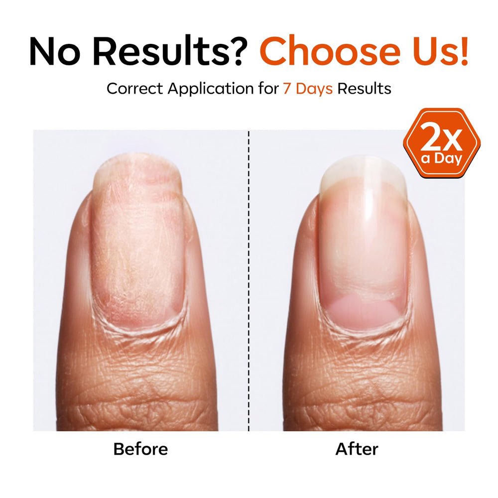 modelones toenail treatment in use protecting and repairing toenails