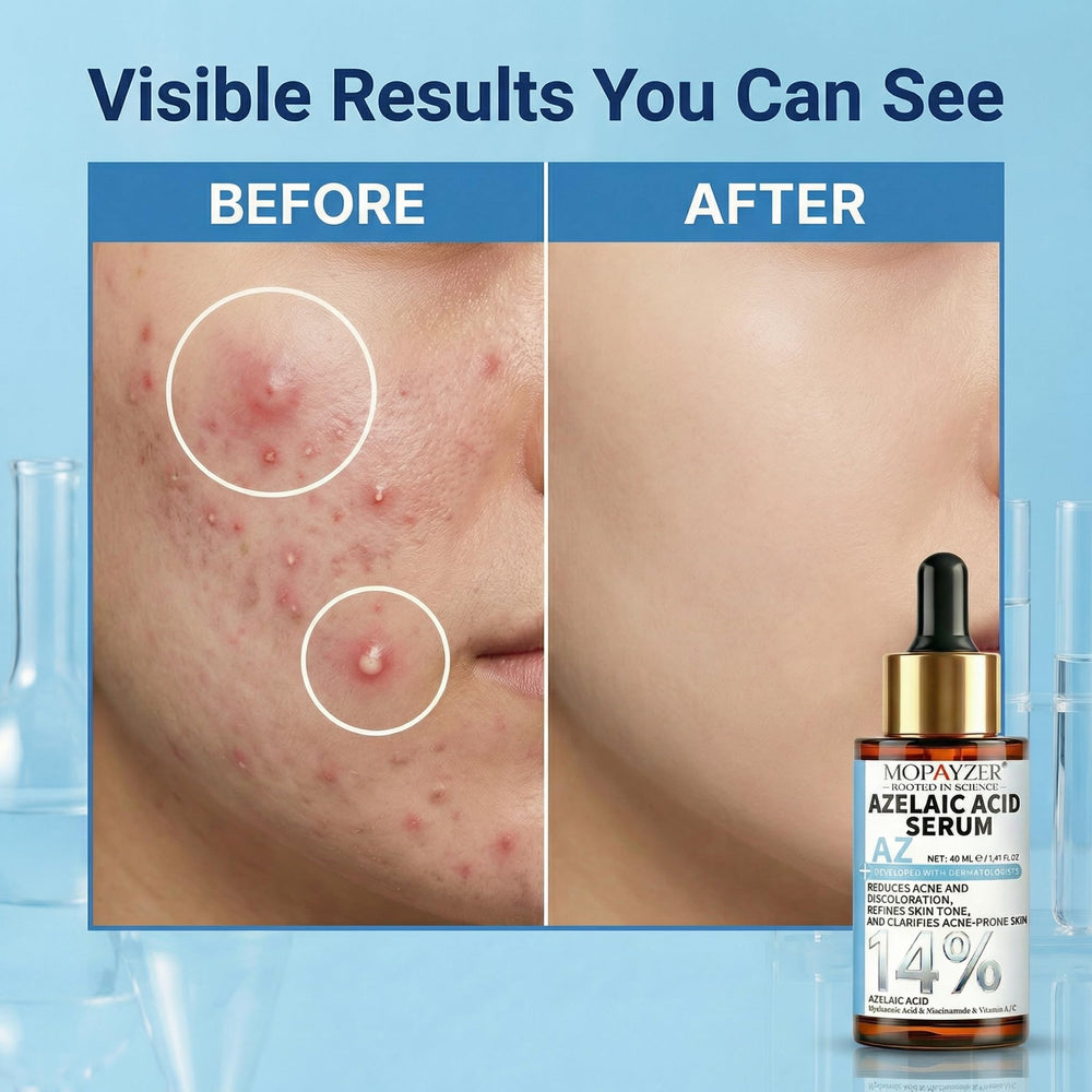 mopayzer serum drop on hand showing lightweight texture and quick absorption