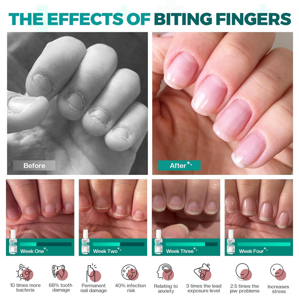 Morovan before-and-after nails showing reduced damage and healthier growth