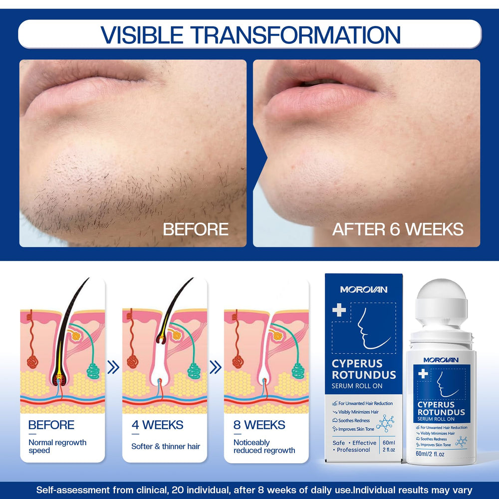 Morovan rollerball tip close-up demonstrating smooth, cooling application benefit