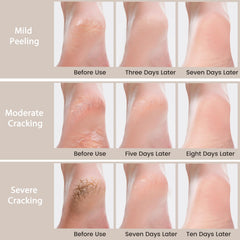 Mouriven before and after feet photo, illustrates visible smoothing benefit