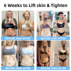 MOYEE targeted use on elbows and knees for smoother skin