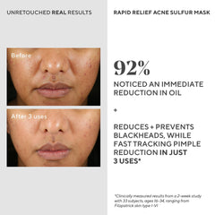Murad mask applied on clean face, demonstrating easy at-home treatment benefits