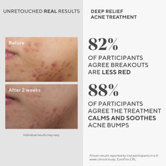 Murad applied to a blemish illustrating targeted, discreet coverage