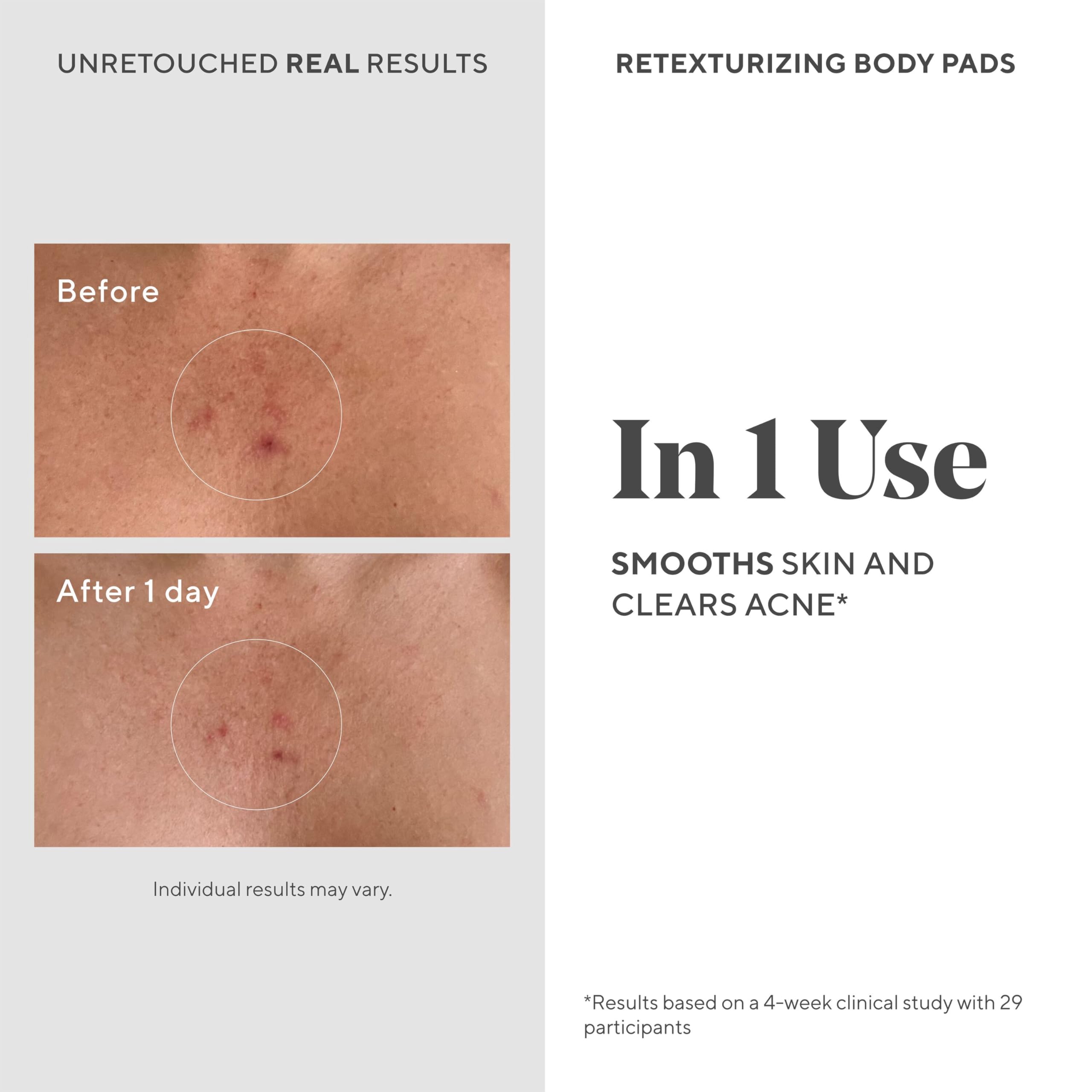 Murad pad in hand applying to skin for quick exfoliation