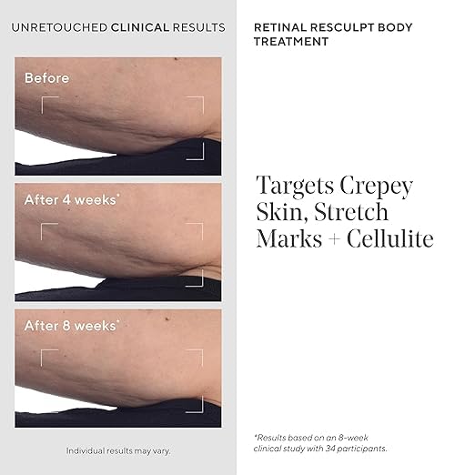 Murad being applied to thigh to show firming and smoothing benefit