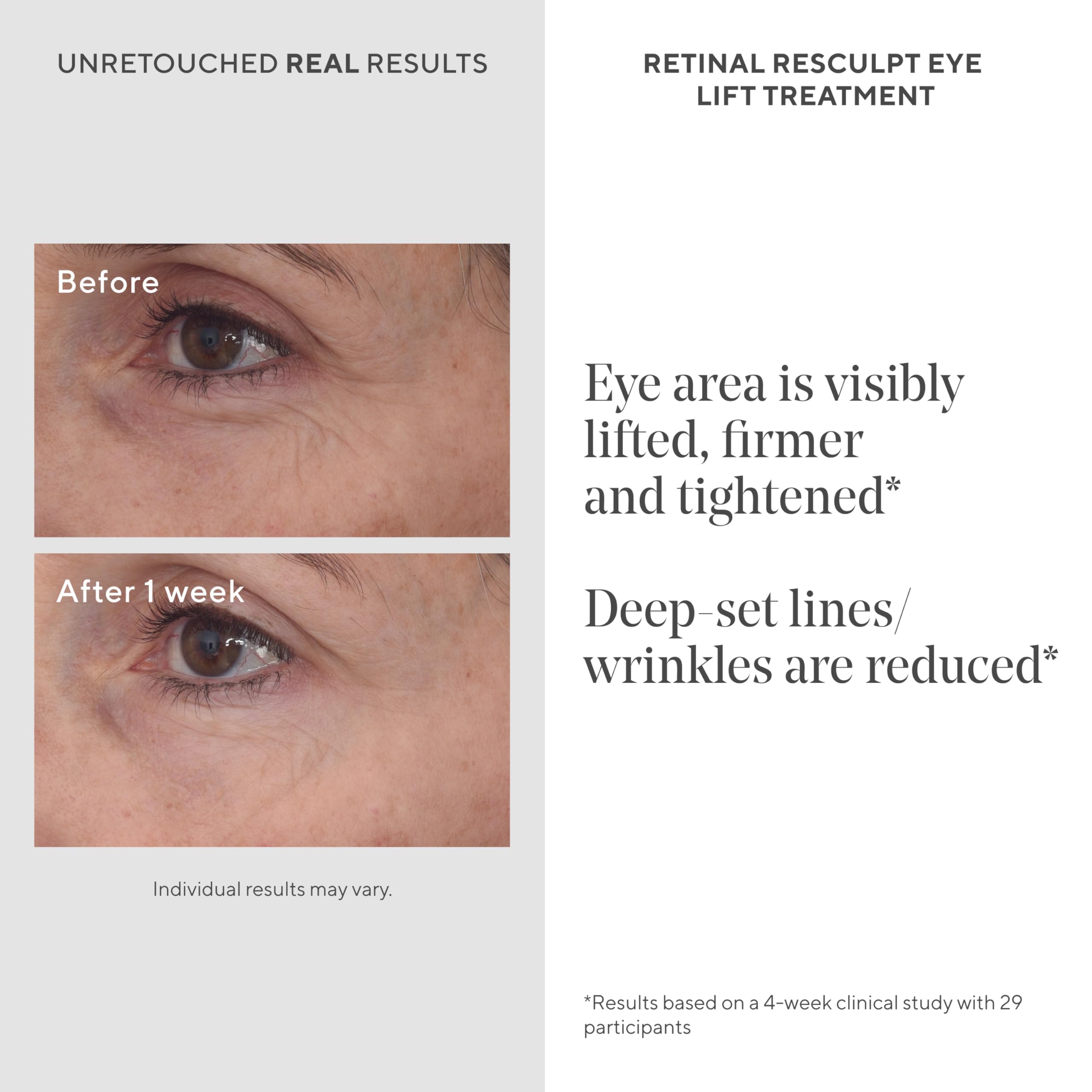 Murad retinal ReSculpt gentian root extract close-up highlighting natural lifting support