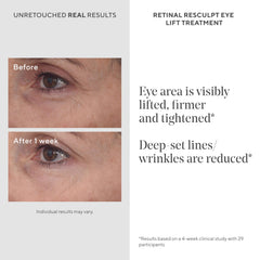 Murad retinal ReSculpt gentian root extract close-up highlighting natural lifting support