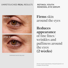 Murad retinol eye serum smooth lightweight texture closeup showing easy absorption