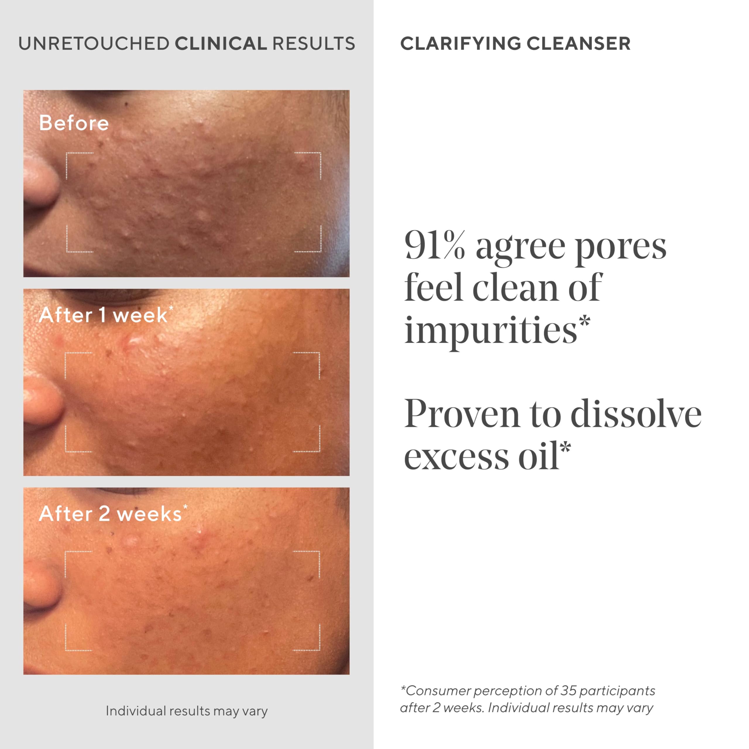 Murad salicylic acid ingredient visual highlighting pore-exfoliating benefit