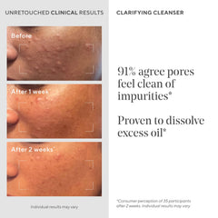 Murad salicylic acid ingredient visual highlighting pore-exfoliating benefit