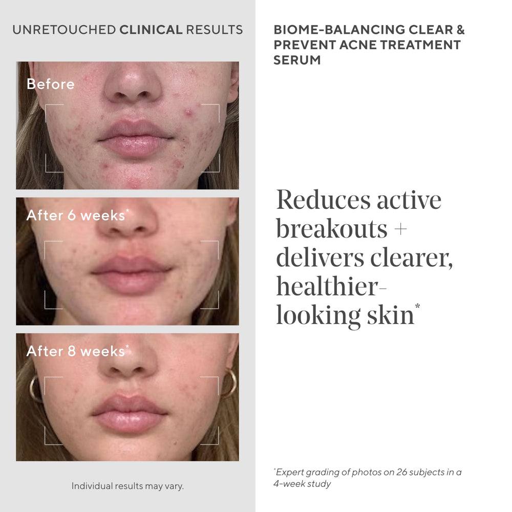Murad cleanser foam texture close-up for gentle deep cleansing benefit